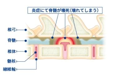 痛みのみの症状