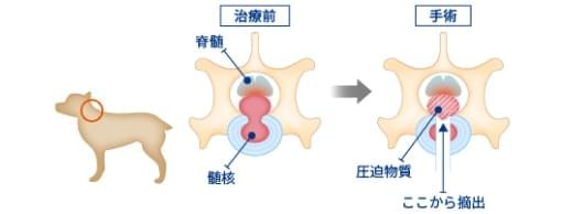 腹側減圧術