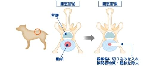 予防的造窓術（開窓術）