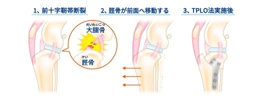 TPLO法（Tibial Plateau Leveling Osteotomy/脛骨高平部水平化骨切り術）