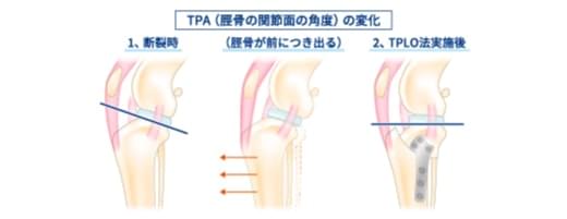 TPLO法（Tibial Plateau Leveling Osteotomy/脛骨高平部水平化骨切り術）