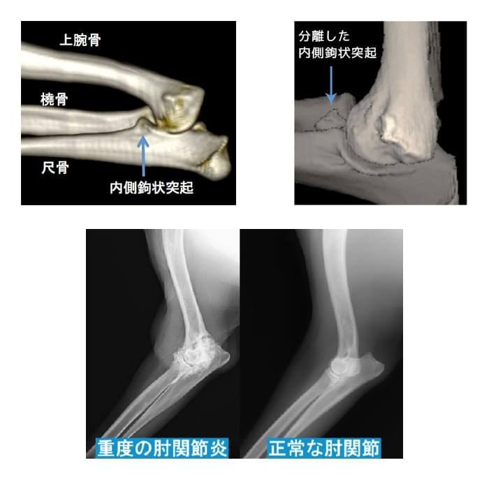 内側鉤状突起分離