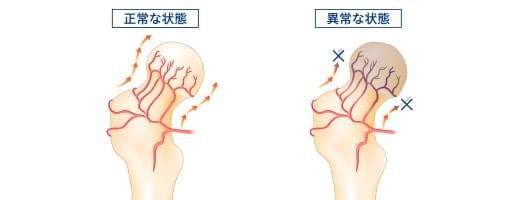 病因およびリスク因子