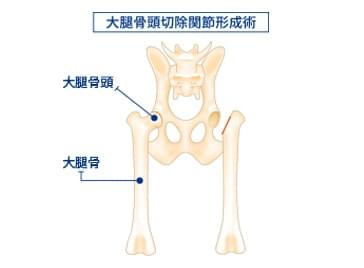 手術