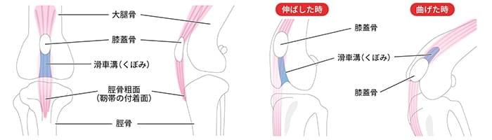 膝蓋骨脱臼とは