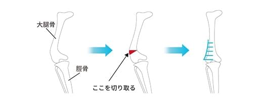 外側（膝蓋骨外方脱臼では内側）組織の縫縮