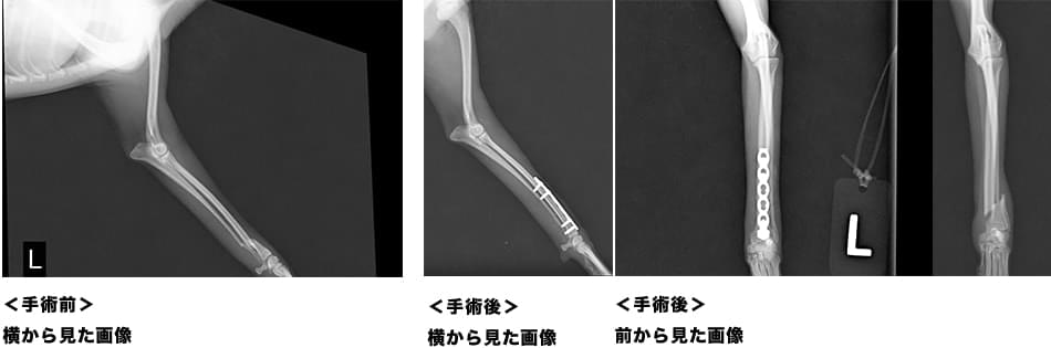 実際の治療前後の写真