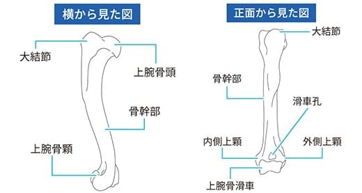 上腕骨骨折