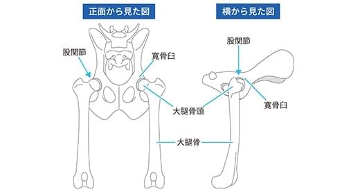 股関節脱臼