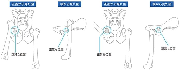 股関節脱臼の特徴・症状